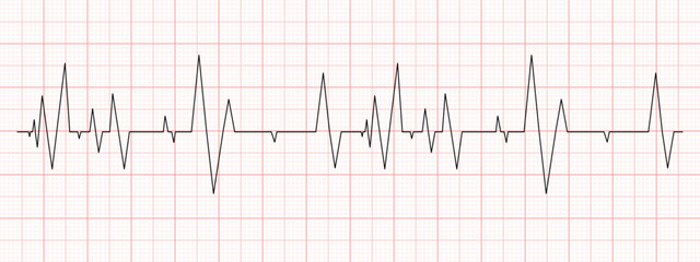 Black heartbeat diagram on red graph paper. Electrocardiogram chart. Cardio test line. Cardiac rhythm symbol. Vector graphic illustration