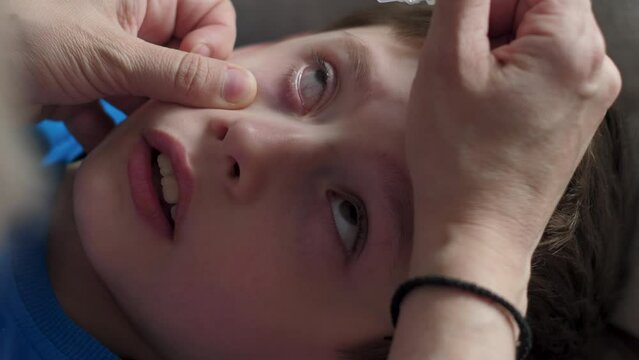 a European boy 7-9 years old is instilled with eye drops in his eyes, treatment of conjunctivitis, allergies in children. boy taking eye drops
