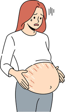 Pregnant woman with stretchmarks on belly