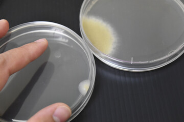 Colonies of bacteria growth on agar plate medium in laboratory.