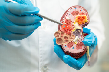 Kidney disease, Chronic kidney disease ckd, Doctor hold model to study and treat in hospital.