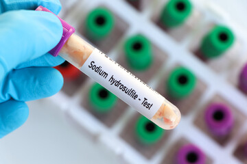 Fototapeta premium Sodium hydrosulfite, food sample to analyze in the laboratory