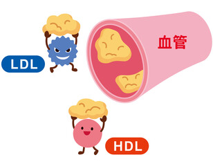 LDLとHDLの仕組み　脂質異常症　血管　コレステロール