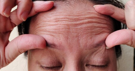 close up the fingers holding the flabbiness and wrinkle, forehead lines and flabby skin on the face...