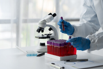 A scientist or medical technician wearing PPE and wearing a glove holds patient-derived blood vessels and researches them in a sample rack to prepare for testing and qualitative concentrations.