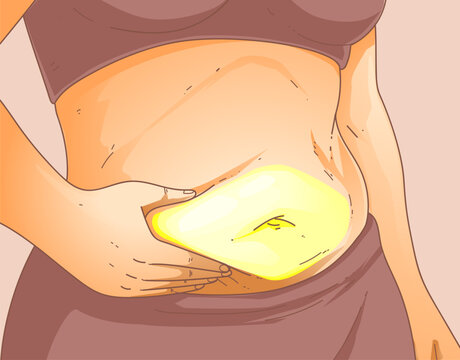 A woman's body with problem areas. Belly fat. Medical infographic. Healthcare illustration. Vector illustration. 