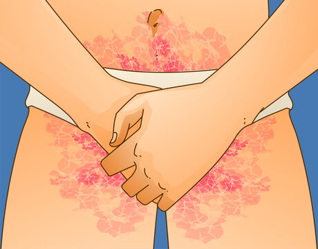 The human body with skin disease. Healthcare illustration. Vector illustration. 