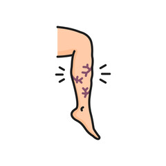 Varicose vein, venous edema, hypoproteinemia treatment disease isolated color line icon. Vector venous disease leg swelling, vascular mesh on legs - obrazy, fototapety, plakaty