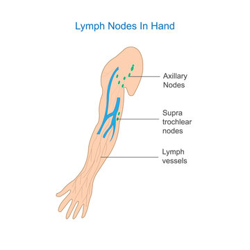 Lymph Node Anatomy. Labeled diagram showing the lymph nodes in hand.