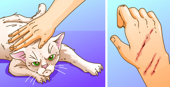 Human caresses cat. Cat scratched a human. Scratches on the skin. Healthcare illustration. Vector illustration.