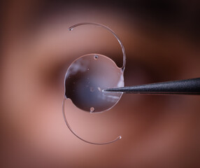 photo of intra ocular lens IOL for treating cataract infront of surgeon eye - obrazy, fototapety, plakaty