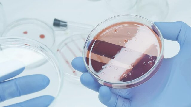 Bacteria and microbial cultures growth on a petri dish in microbiology lab. Candida auris. Biomarker. Bio-reagent. Fungus and mold. Cyanobacteria. Culture medium plate. Hold petry dish. Blue gloves.