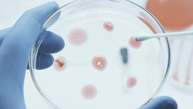 Bacteria culture growth on a petri dish in microbiology lab. Candida auris. Microbial cultures growth on selective media plate. Biomarker. Bio-reagent. Fungus and mold.  Biomass. Colony-forming unit