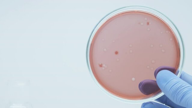Bacteria culture growth on a petri dish in microbiology lab. Candida auris. Microbial cultures growth on selective media plate in microbiology laboratory. Biomarker. Bio-reagent. Fungus and mold.