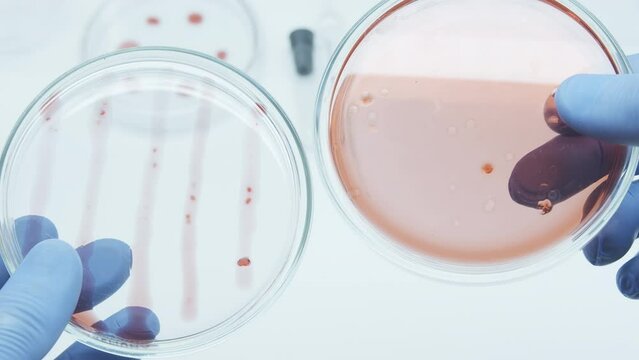 Bacteria and microbial cultures growth on a petri dish in microbiology lab. Candida auris. Biomarker. Bio-reagent. Fungus and mold. Cyanobacteria Colony samples. Culture medium plate. 