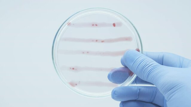 Bacteria culture growth on a petri dish in microbiology lab. Candida auris. Microbial cultures growth on selective media plate in microbiology laboratory. Biomarker. Bio-reagent. Fungus and mold.