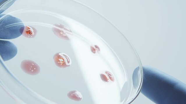 Bacteria culture growth on a petri dish in microbiology lab. Candida auris. Microbial cultures growth on selective media plate in microbiology laboratory. Biomarker. Bio-reagent. Fungus and mold.