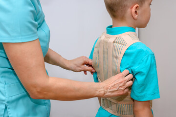 Orthopedist helping patient to put on posture corrector in clinic. closeup. Scoliosis treatment - obrazy, fototapety, plakaty