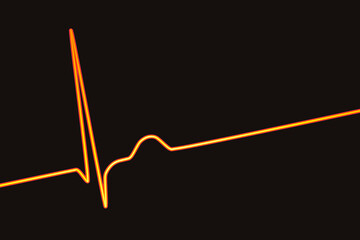 Electrocardiogram ECG displaying a junctional rhythm, 3D illustration