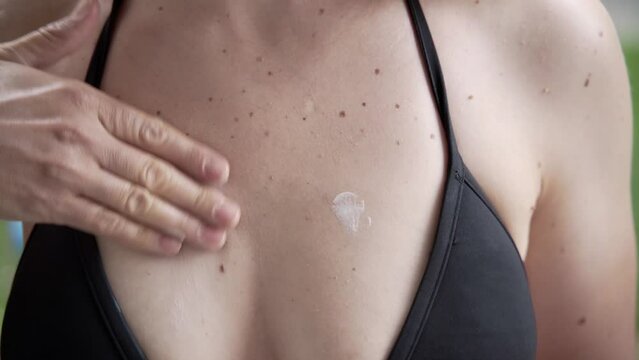 Close-up of a woman's hand applying cream to a breast covered with moles. A woman lubricates with a cream the skin on which there are many moles