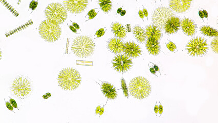 Phytoplankton (Micrasterias, staurastrum, Spondylosium, Staurodesmus, diatom, etc) blooming under...