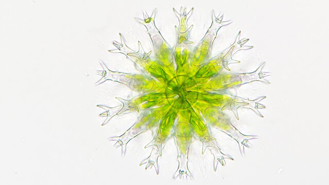 Staurastrum sp, a microalgae with a lot of hand-like structure. Live cell. 40x objective lens. Selective focus
