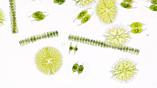 Phytoplankton (Micrasterias, staurastrum, Spondylosium, Staurodesmus, diatom, etc) blooming under microscope. 200x magnification. Selective focus