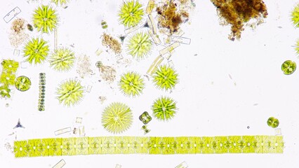 Phytoplankton (Micrasterias, staurastrum, Spondylosium, Staurodesmus, diatom, etc) blooming under...