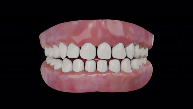3D animation real tooth braces movement to normally pose with alpha matte.