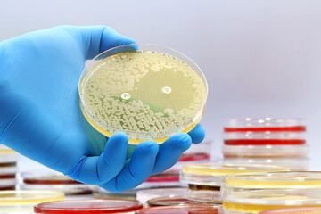 The rise of antibiotic-resistant bacterial infections. Super bugs. A microbiological culture Petri dish with bacteria and an antibiotic resistance test  - obrazy, fototapety, plakaty