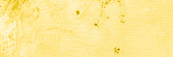 Metal Bacteria. Bacteria Electron. Yellow Cough Virus. Gold Immunity. Cancer Cell Receptor. Brown Cute Bacteria. Cancer Research Dna. Cancer Gene. Car T Cell.