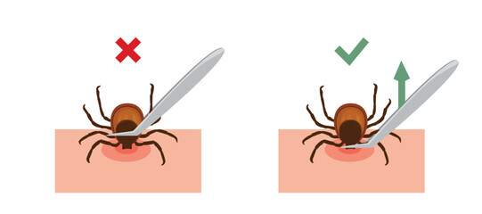Correct way to remove tick of skin after bite insect correctly, vector