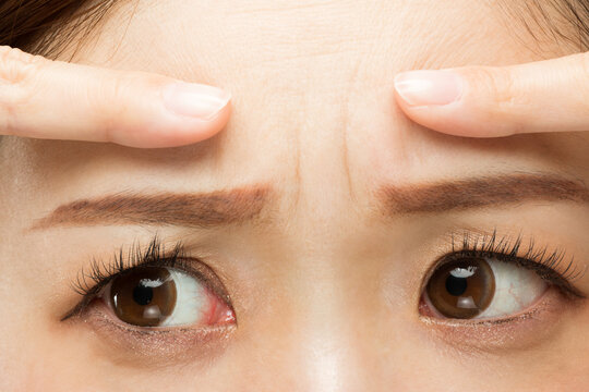 Glabella Bilder Durchsuchen 688 Archivfotos, und