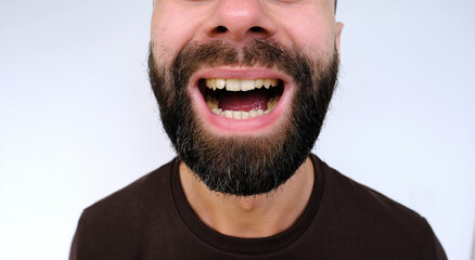 close-up of male mouth performs articulation exercises, patient neurologist with stuttering,...