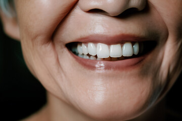 close up of a smile, senior woman smiling, ai generated