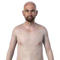 Fototapeta premium A 3D photorealistic illustration showcasing the upper half part of a man with a beard, devoid of hair, revealing his skin and facial features