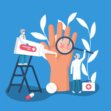 A dermatologist examines infected skin. Big hand with pimples or eczema. Rash on the skin. Treatment of the disease, a doctor with medical preparations and ointment. Vector illustration flat design.