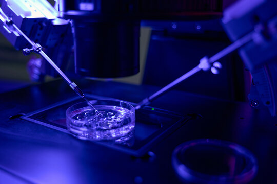 Micromanipulator catching spermatozoa to make injection into oocyte