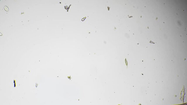 Sample of pond water with microorganisms living there magnified under microscope against white background. Gastrotrich is moving around itself among protozoa life beings. Studying planktons concept