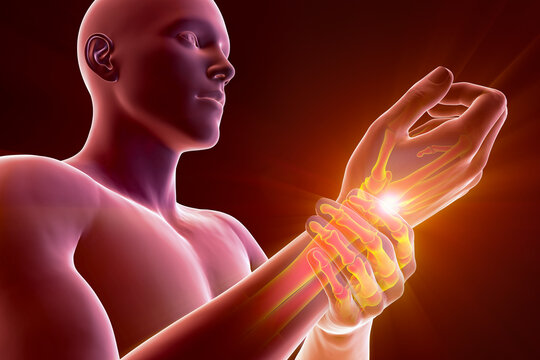 A man experiencing wrist pain, 3D illustration