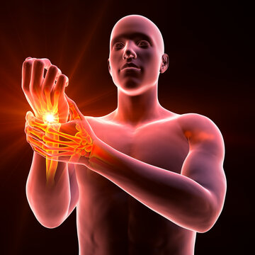 A man experiencing wrist pain, 3D illustration