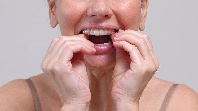 Close-up middle-aged woman putting on transparent aligners on the upper jaw Dental care and dentistry orthodontic concept