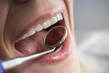 Dental exam close up of happy mouth