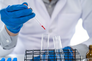 Doctor hand taking a blood sample tube from a rack with machines of analysis in the lab background, Technician holding blood tube test in the research laboratory.