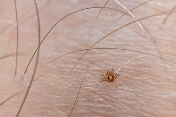  Tiny tick attached to human skin. Intricate details reveal a parasitic encounter.