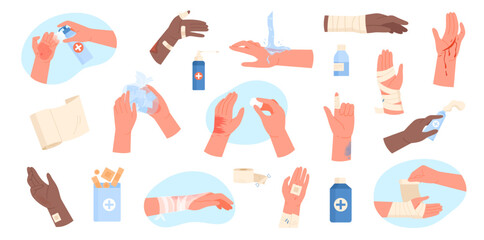 Injured hands set vector illustration. Cartoon isolated human arms with wounds and burn on body skin, cleaning and dressing with bandages, applying medical treatment for injury, first aid for trauma