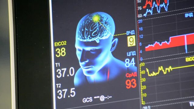 Patient monitor close-up. Monitor with different patient vital signs in hospitals. Image man, head, brains, lines, data, indicators, information. Modern medicine equipment tool. Medical monitor. ECG