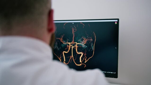 the patient undergoes computer tomography in the clinic, the radiologist monitors the progress of the procedure and the results of the lung scan