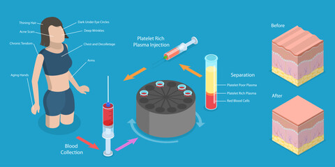 3D Isometric Flat Vector Conceptual Illustration of PRP Procedure, Women Beauty and Skincare