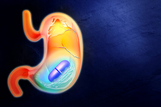 Heartburn treatment. Illustration of unhealthy stomach with antacid pill on dark blue background, space for text. Water symbolizing result of treatment